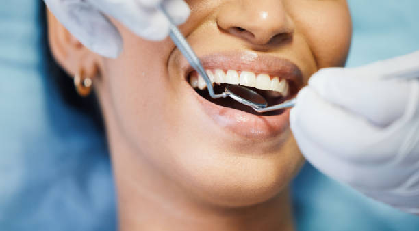 Best Emergency Root Canal Treatment in Benson, NC